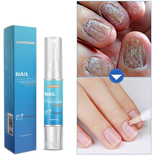 Fungal nail treatment - fungal,