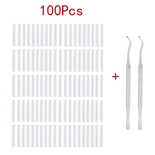 Ingrown toenail corrector - toenail,