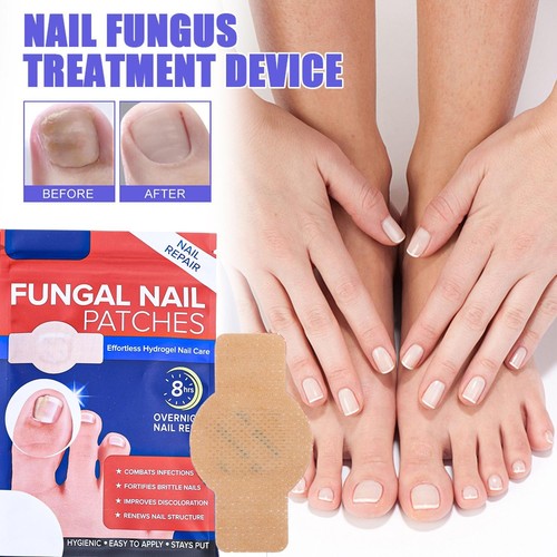 Anti fungal nail treatment - fungal,