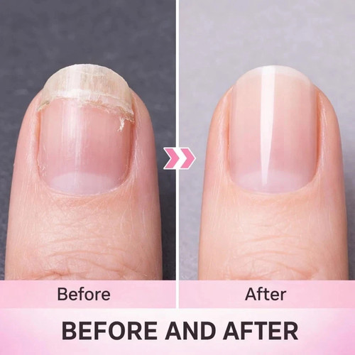 Roll fiberglass silk nail - roll,